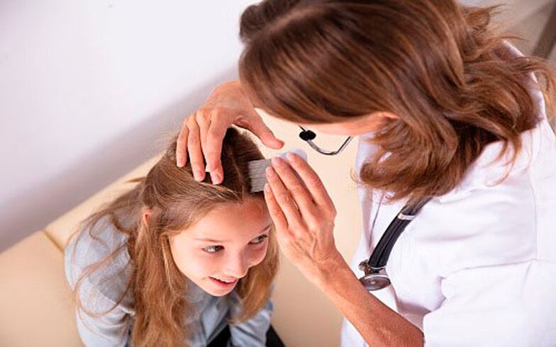 лечение на псориазис на главата при деца